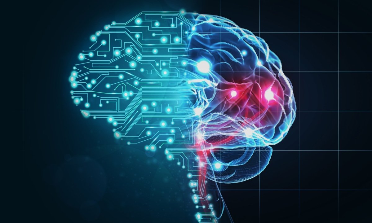 ©AI-STROKE ©AI-STROKE