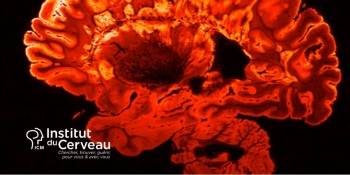 © Institut du Cerveau